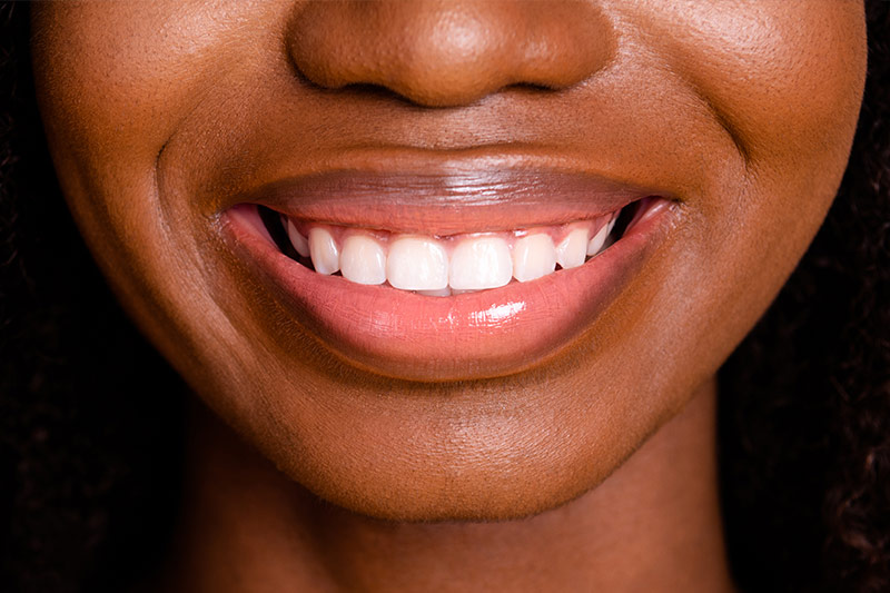 Teeth in a Day in Hicksville & Farmingdale