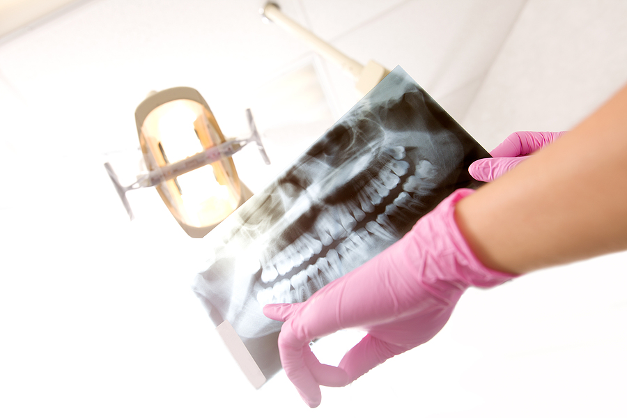 General Dentistry: Why Do I Need X-Rays?