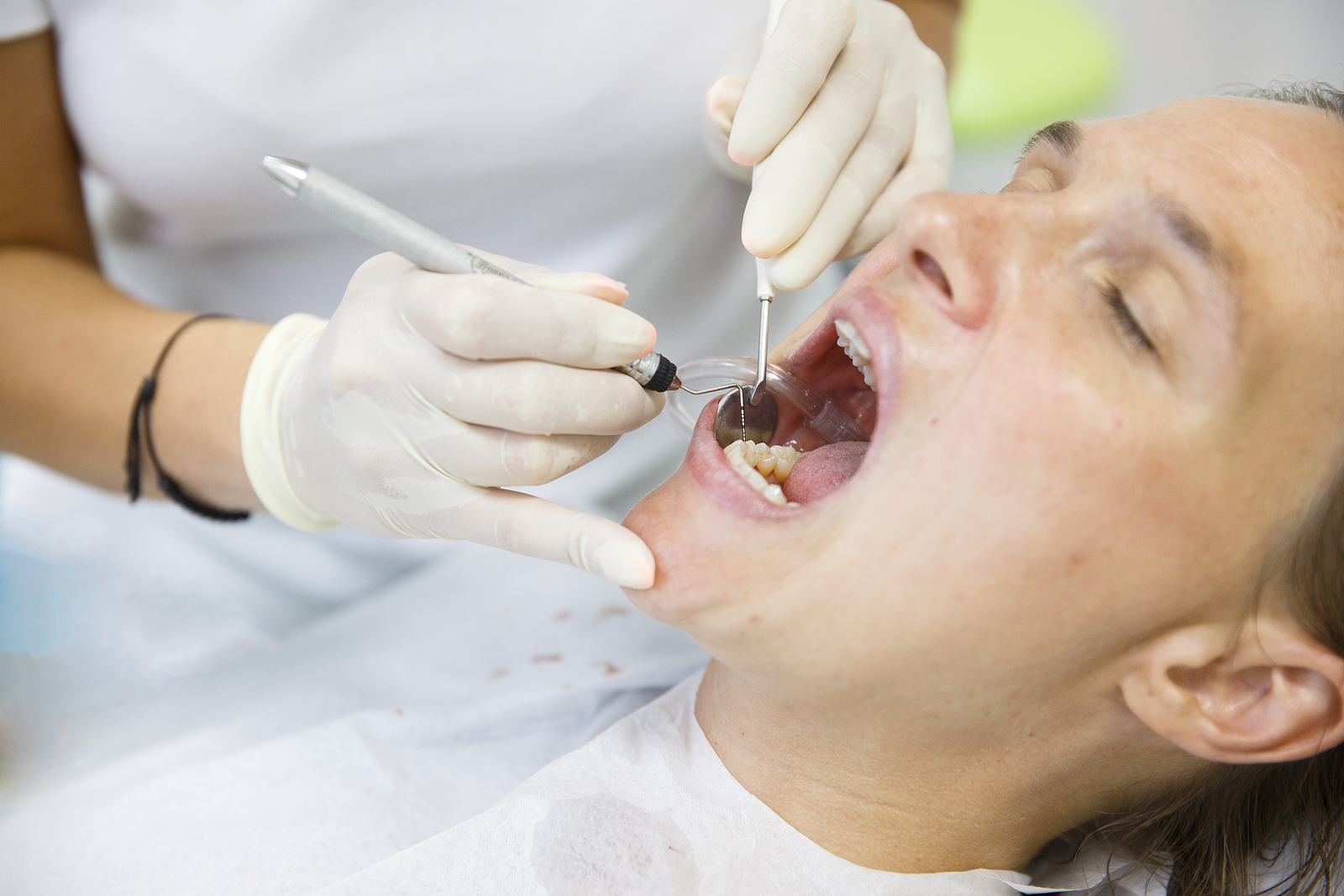 How to Keep Your Tooth Healthy After a Root Canal: Long-Term Aftercare Tips